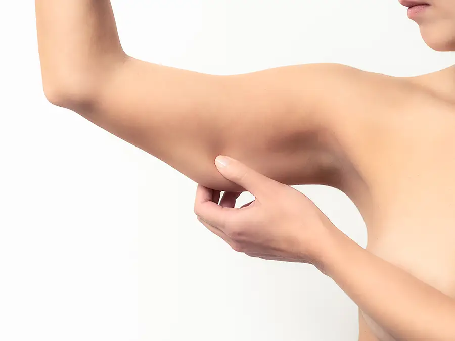 Chirurgie brachioplastie