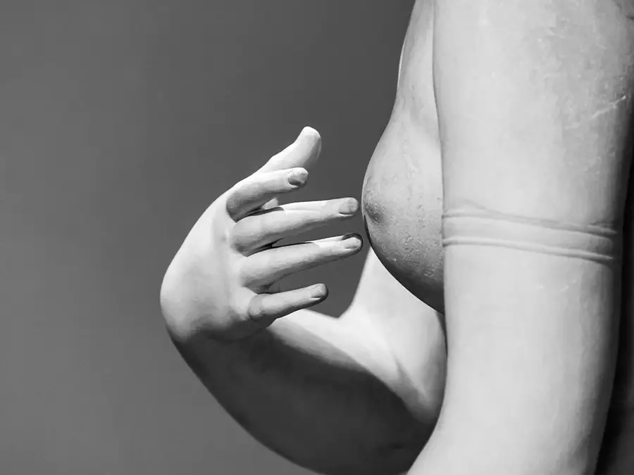 Chirurgie du mamelon en Morbihan.