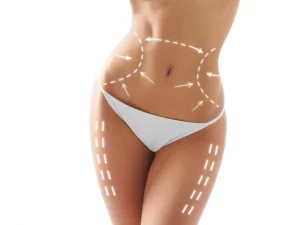 Chirurgie silhouette